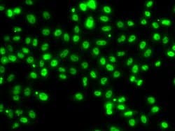 Invitrogen SETBP1 Polyclonal Antibody 100 &mu;L | Buy Online | Invitrogen&trade; | Fisher Scientific