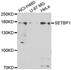Invitrogen SETBP1 Polyclonal Antibody 100 &mu;L | Buy Online | Invitrogen&trade; | Fisher Scientific