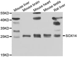 Invitrogen SOX14 Polyclonal Antibody 100 &mu;L; Unconjugated:Antibodies,