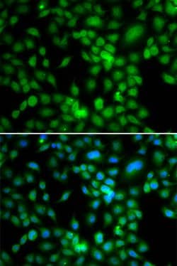 Invitrogen SYCE1 Polyclonal Antibody 100 &mu;L; Unconjugated:Antibodies,