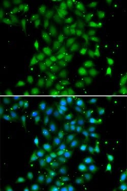 Invitrogen UBE2Z Polyclonal Antibody 100 &mu;L; Unconjugated:Antibodies,