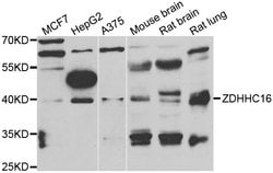 Invitrogen ZDHHC16 Polyclonal Antibody 100 &mu;L; Unconjugated:Antibodies,