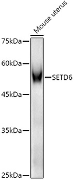 Invitrogen SETD6 Polyclonal Antibody 100 &mu;L; Unconjugated:Antibodies,