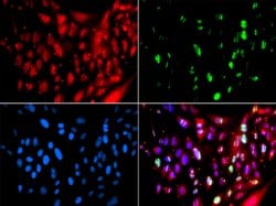 Invitrogen RAP80 Polyclonal Antibody 100 &mu;L; Unconjugated:Antibodies,