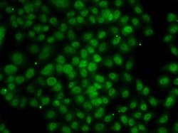 Invitrogen ATMIN Polyclonal Antibody 100 &mu;L; Unconjugated:Antibodies,