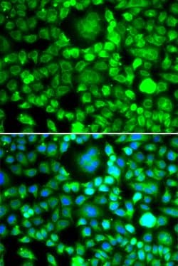 Invitrogen BLID Polyclonal Antibody 100 &mu;L; Unconjugated:Antibodies,