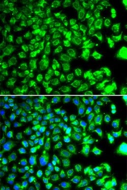 Invitrogen C10orf32 Polyclonal Antibody 100 &mu;L; Unconjugated:Antibodies,