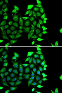 Invitrogen IKZF3 Polyclonal Antibody 100 &mu;L; Unconjugated:Antibodies,