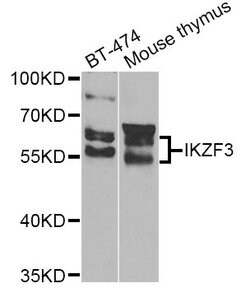 Invitrogen IKZF3 Polyclonal Antibody 100 &mu;L; Unconjugated:Antibodies,