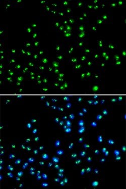 Invitrogen NAT10 Polyclonal Antibody 100 &mu;L; Unconjugated:Antibodies,