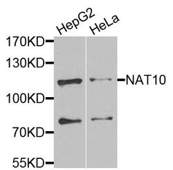 Invitrogen NAT10 Polyclonal Antibody 100 &mu;L; Unconjugated:Antibodies,