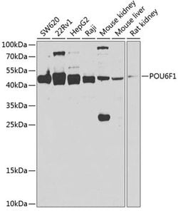 Invitrogen POU6F1 Polyclonal Antibody 100 &mu;L; Unconjugated:Antibodies,