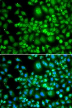Invitrogen SETD5 Polyclonal Antibody 100 &mu;L; Unconjugated:Antibodies,