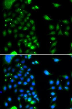Invitrogen UBE2J2 Polyclonal Antibody 100 &mu;L; Unconjugated:Antibodies,