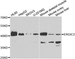Invitrogen ERGIC2 Polyclonal Antibody 100 &mu;L; Unconjugated:Antibodies,