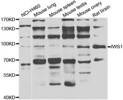 Invitrogen IWS1 Polyclonal Antibody 100 &mu;L; Unconjugated:Antibodies,