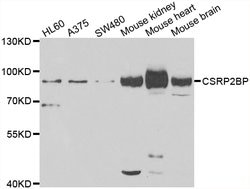 Invitrogen CSRP2BP Polyclonal Antibody 100 &mu;L; Unconjugated:Antibodies,