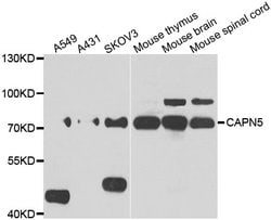 Invitrogen Calpain 5 Polyclonal Antibody 100 &mu;L | Buy Online | Invitrogen&trade; | Fisher Scientific