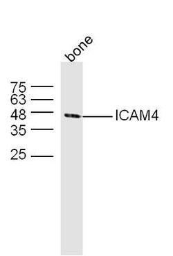 Invitrogen ICAM-4 Polyclonal Antibody 100 &mu;L; Unconjugated:Antibodies,