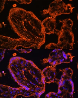 Invitrogen LDB3 Polyclonal Antibody 100 &mu;L; Unconjugated:Antibodies,