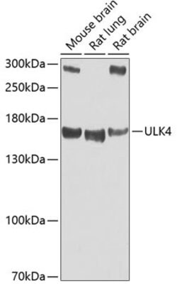 Invitrogen ULK4 Polyclonal Antibody 100 &mu;L; Unconjugated:Antibodies,