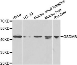 Invitrogen GSDMB Polyclonal Antibody 100 &mu;L; Unconjugated:Antibodies,