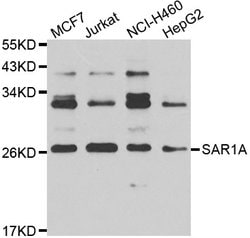 Invitrogen SAR1A Polyclonal Antibody 100 &mu;L; Unconjugated:Antibodies,