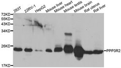 Invitrogen PPP3R2 Polyclonal Antibody 100 &mu;L; Unconjugated:Antibodies,