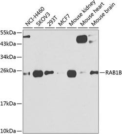 Invitrogen RAB1B Polyclonal Antibody 100 &mu;L; Unconjugated:Antibodies,