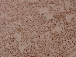COL5A3 Polyclonal Antibody:Antibodies, Polyclonal