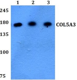 COL5A3 Polyclonal Antibody:Antibodies, Polyclonal