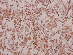 Invitrogen KCNMB2 Polyclonal Antibody 100 &mu;L; Unconjugated:Antibodies,