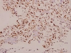 NDUFS5 Polyclonal Antibody 100 &mu;L | Buy Online | Invitrogen | Fisher Scientific