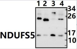 NDUFS5 Polyclonal Antibody 100 &mu;L | Buy Online | Invitrogen | Fisher Scientific