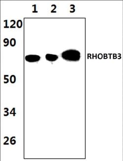 Invitrogen RhoBTB3 Polyclonal Antibody 100 &mu;L | Buy Online | Invitrogen&trade; | Fisher Scientific