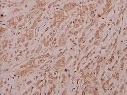 Invitrogen TAIP12 Polyclonal Antibody 100 &mu;L; Unconjugated:Antibodies,