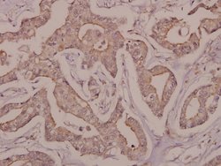 Invitrogen DRAK2 Polyclonal Antibody 100 &mu;L; Unconjugated:Antibodies,