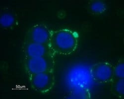 alpha-1b Adrenergic Receptor (extracellular) Polyclonal Antibody, Invitrogen