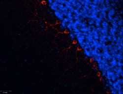 alpha-1b Adrenergic Receptor (extracellular) Polyclonal Antibody, Invitrogen