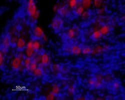 TRPV1 (extracellular) Polyclonal Antibody, Invitrogen 50 &mu;L; Unconjugated:Anticuerpos