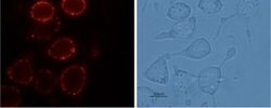 TRPV2 (extracellular) Polyclonal Antibody, Invitrogen 50 &mu;L; Unconjugated:Antibodies,