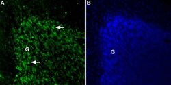 TPCN2 (extracellular) Polyclonal Antibody, Invitrogen 50 &mu;L; Unconjugated:Antibodies,