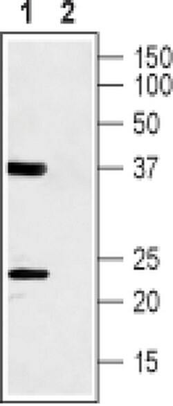 CACNG1 (extracellular) Polyclonal Antibody, Invitrogen 50 &mu;L; Unconjugated:Antibodies,