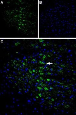 CACNG6 (extracellular) Polyclonal Antibody, Invitrogen 50 &mu;L; Unconjugated:Antibodies,