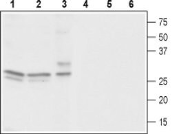 CACNG3 Polyclonal Antibody, Invitrogen 50 &mu;L; Unconjugated:Antibodies,