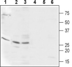 CABP2 Polyclonal Antibody, Invitrogen 50 &mu;L; Unconjugated:Antibodies,