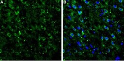 mGluR7 (extracellular) Polyclonal Antibody, Invitrogen 50 &mu;L; Unconjugated:Antibodies,