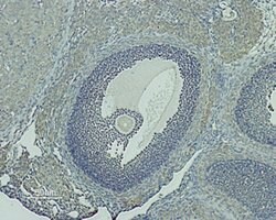 GnRHR (extracellular) Polyclonal Antibody, Invitrogen 50 &mu;L; Unconjugated:Antibodies,