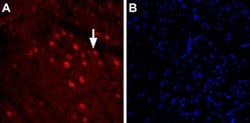 GlyT2 (extracellular) Polyclonal Antibody, Invitrogen 50 &mu;L; Unconjugated:Antibodies,