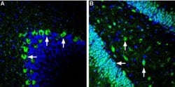 GLUT2 Polyclonal Antibody, Invitrogen 50 &mu;L; Unconjugated:Antibodies,